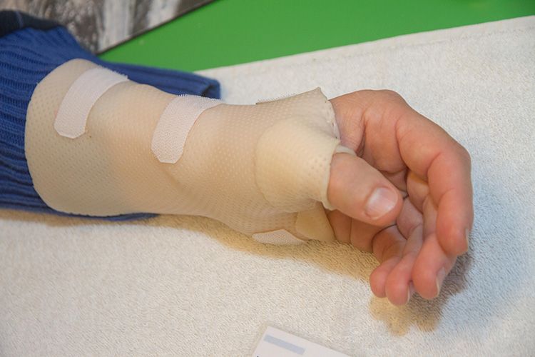 Opsommen driehoek afstand De Quervain :: Handtherapie Soest - Fysiotherapeuten en ergotherapeuten  voor pols en hand